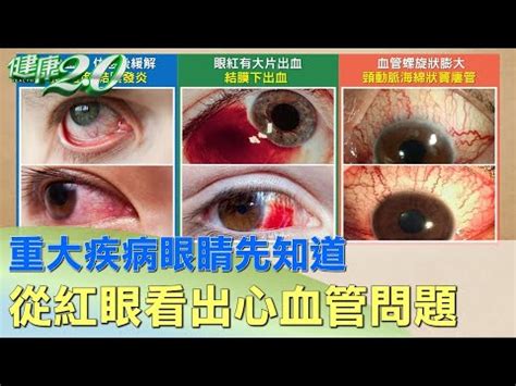 眼白多過眼珠|【眼白多過眼珠】眼白多過眼珠？小心容易記仇、霸佔又固執